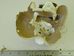 Picture of Paxina acetabulum