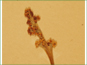 Botrychium simplex sporangia